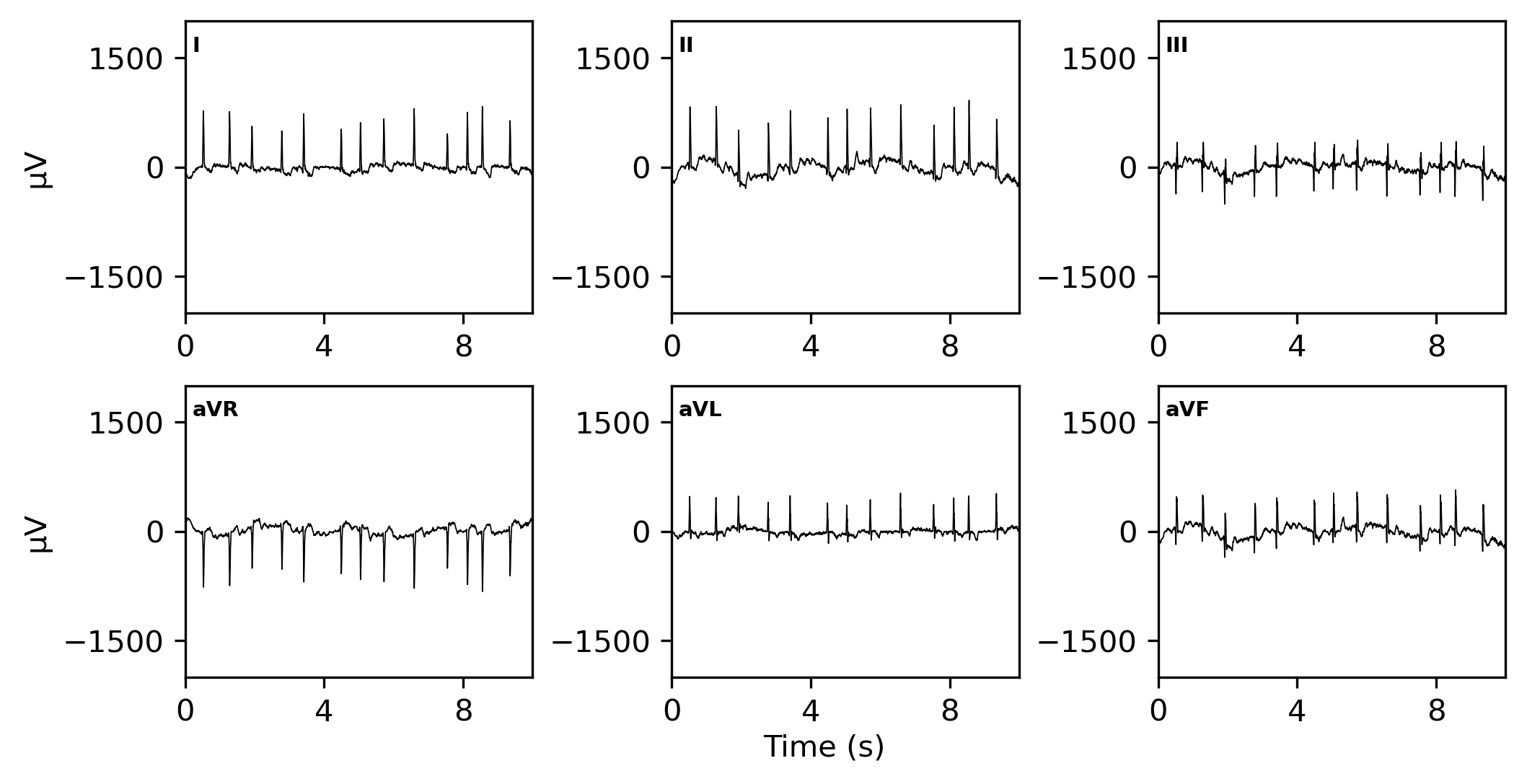 ../../_images/examples_recipe_plot_ecgs_23_1.png