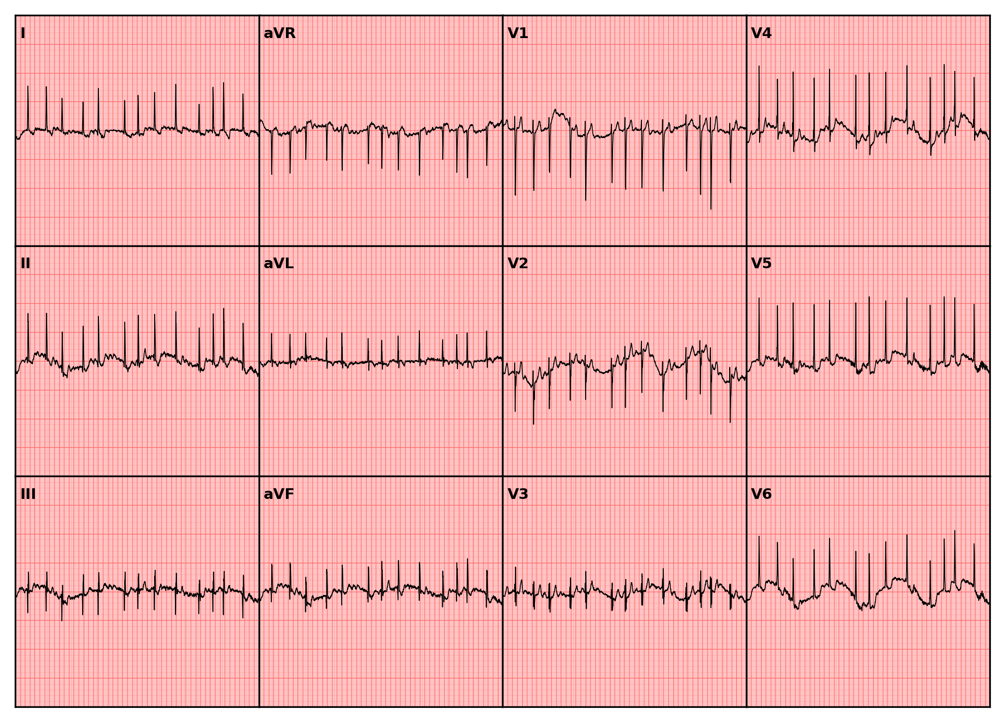 ../../_images/examples_recipe_plot_ecgs_25_1.png